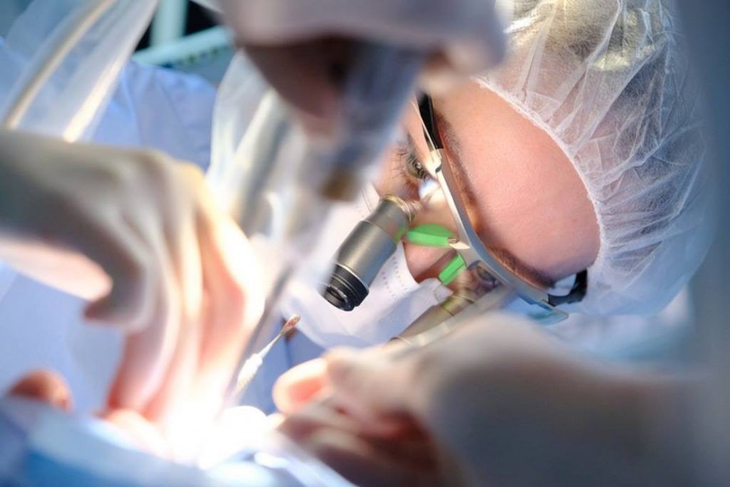 The Implant Process