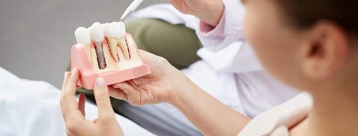 remove the failed implant