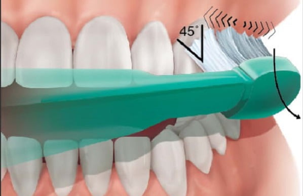 How to prevent ailing and failing dental implant