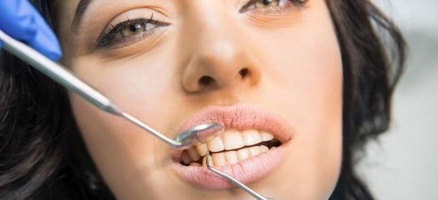 Dental implant removal