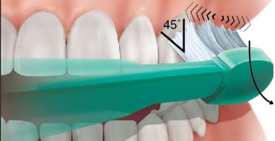 How to prevent ailing and failing of dental implant