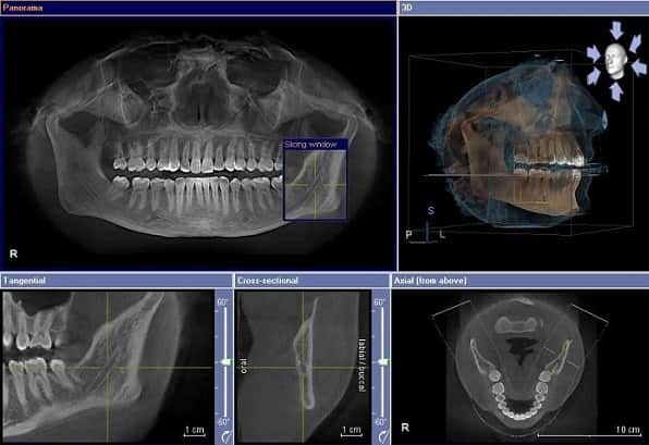 How Does 3D Dentistry Work
