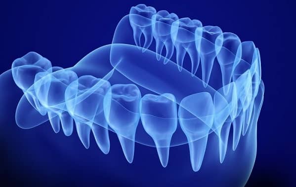 What Are the Diagnostic advantages of 3D Dentistry