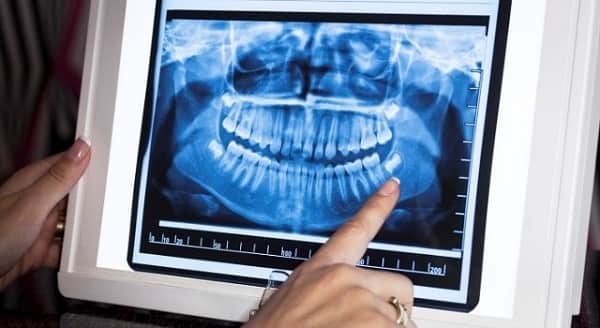 what are the advantages of using 3D dentistry for the patient