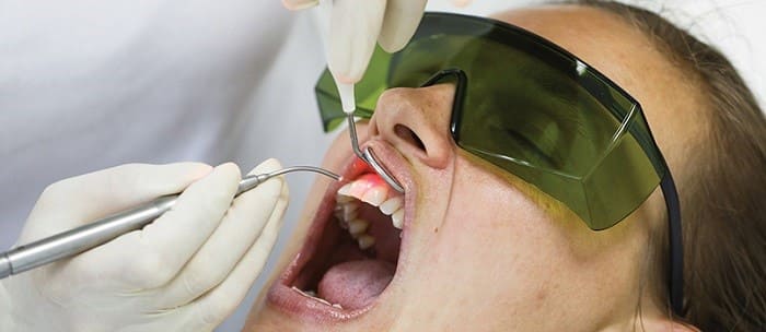 Laser dentistry for failing implant