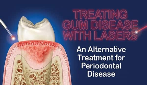 Gum surgery with laser