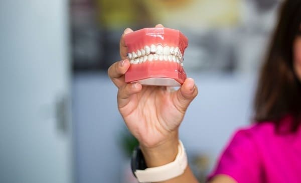 Benefits of choosing dentures