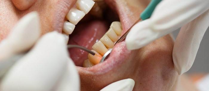 How Are Lasers Used During Oral Surgery