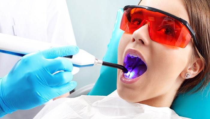 Tooth removal with laser