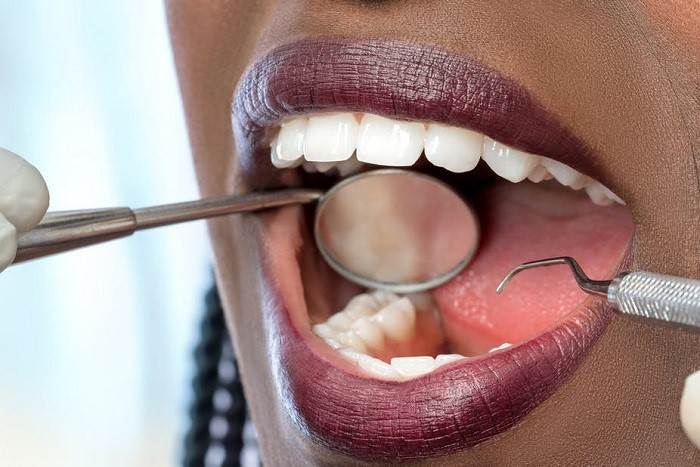 Treatment of gum recession in pregnancy