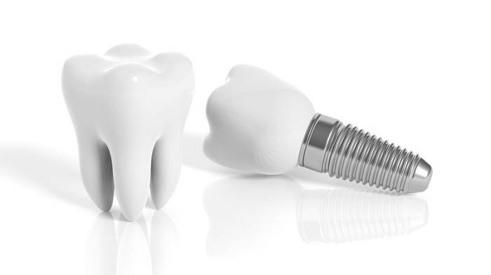What are Zirconia Dental Implants
