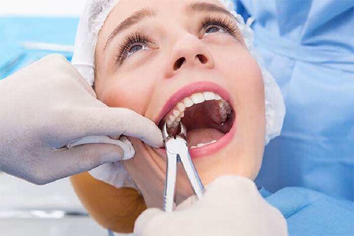 Who should I contact when I think I need an extraction