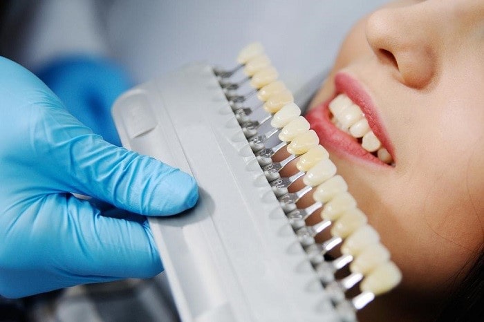 whitened Dental crown