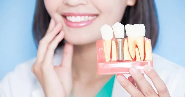 Benefits and Risks of Dental Implants