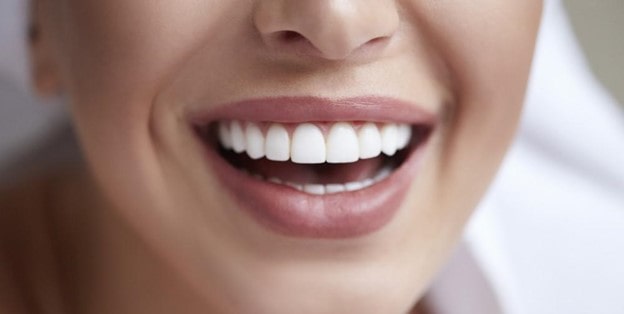 Dental implant success 