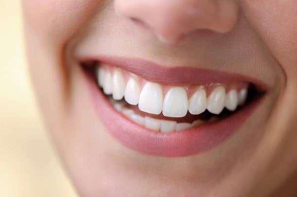 Benefits of All on 4 dental implants