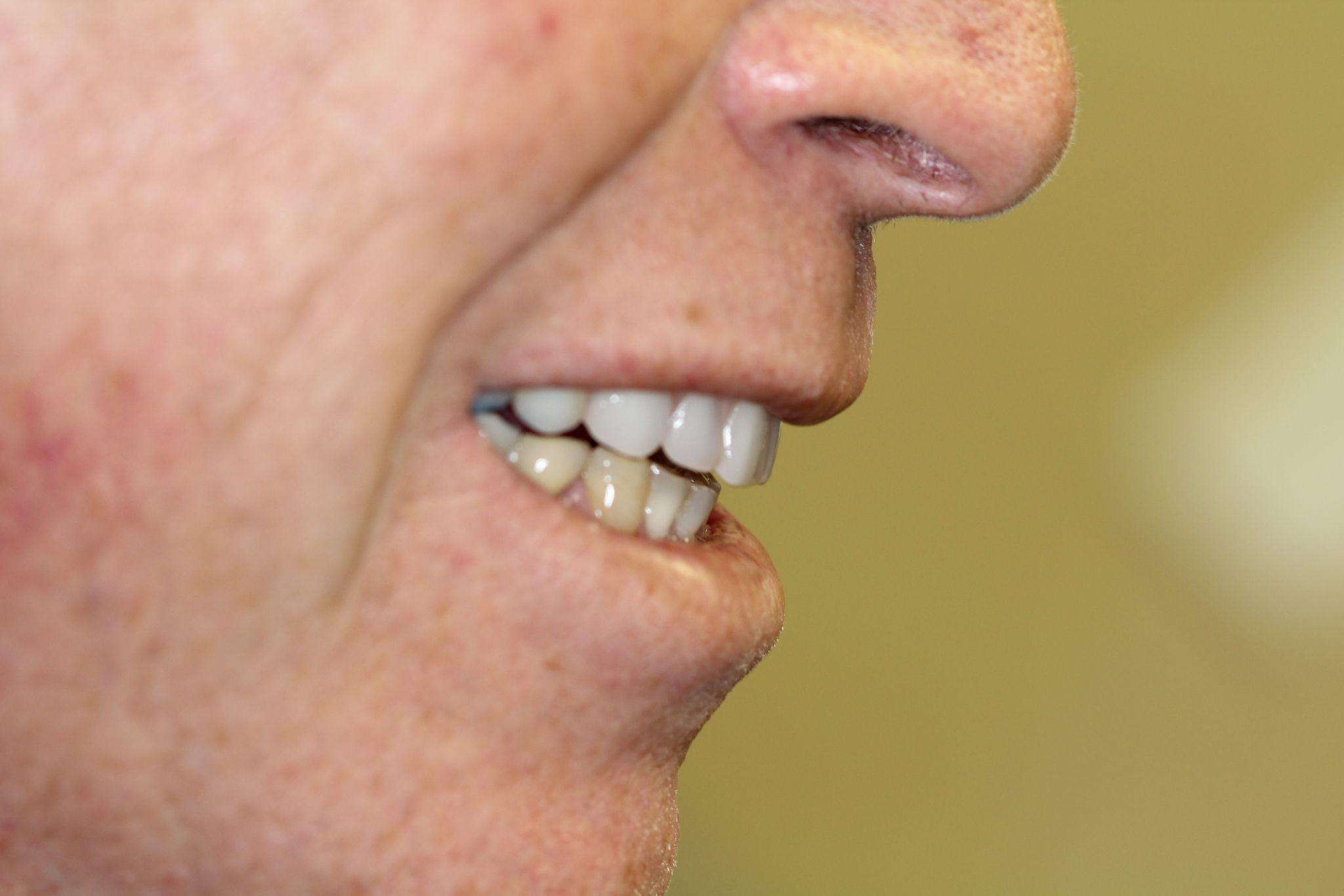 A man smiling with his teeth showing