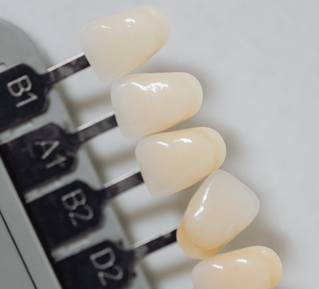 Closeup of implant teeth