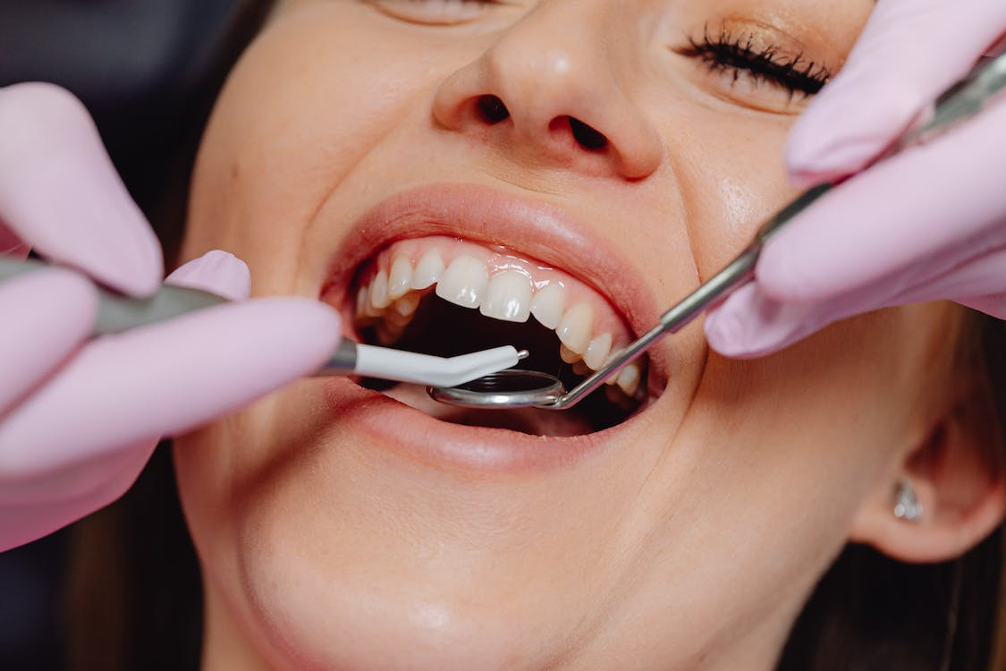 A person getting their teeth examined