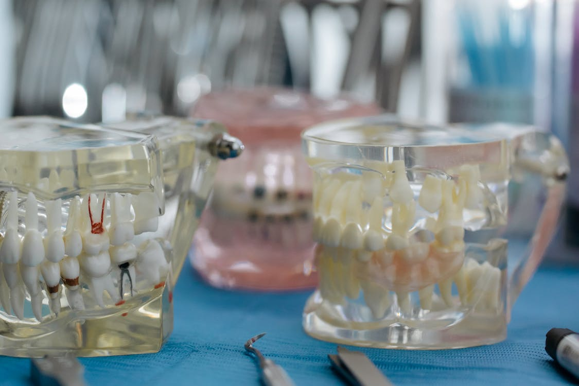Denture models on a dentist’s table