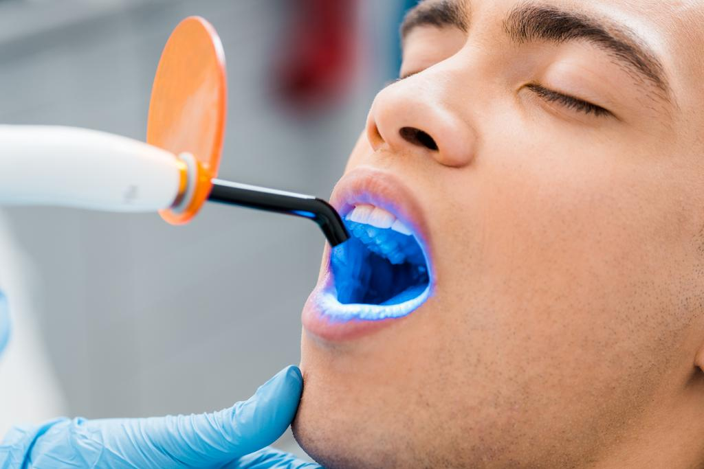 A dentist performing bleaching on a patient's teeth