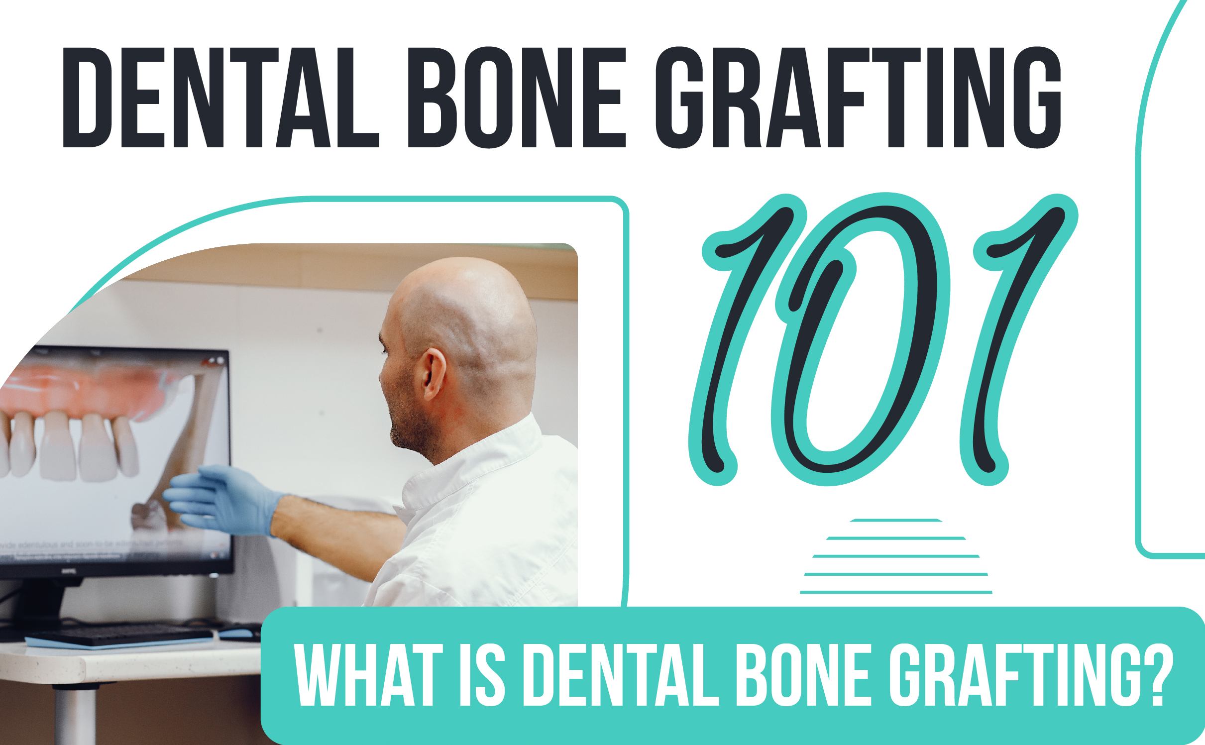 Dental Bone Grafting 101