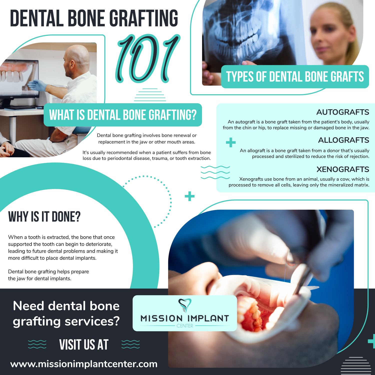 Mission Implant Center