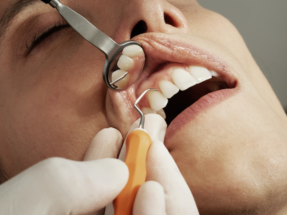 A patient’s mouth close-up
