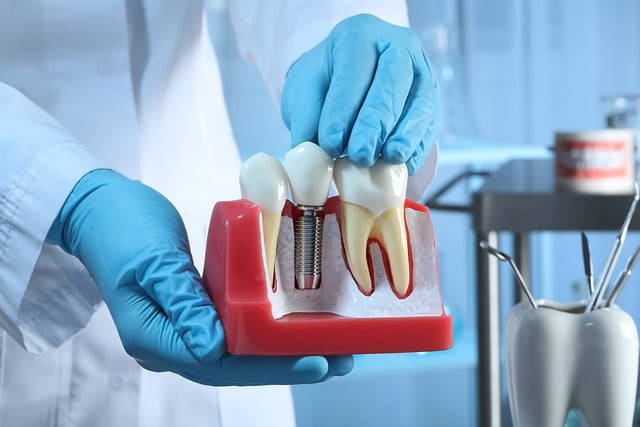 A dentist holding dental implants