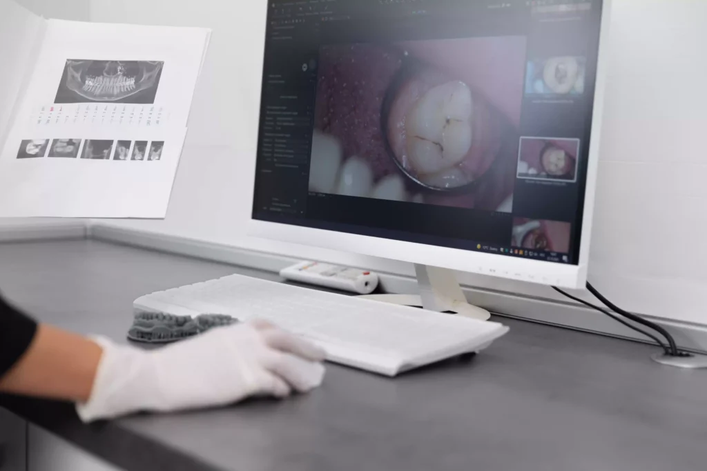 Precision in Surgical Planning and Surgeon Expertise