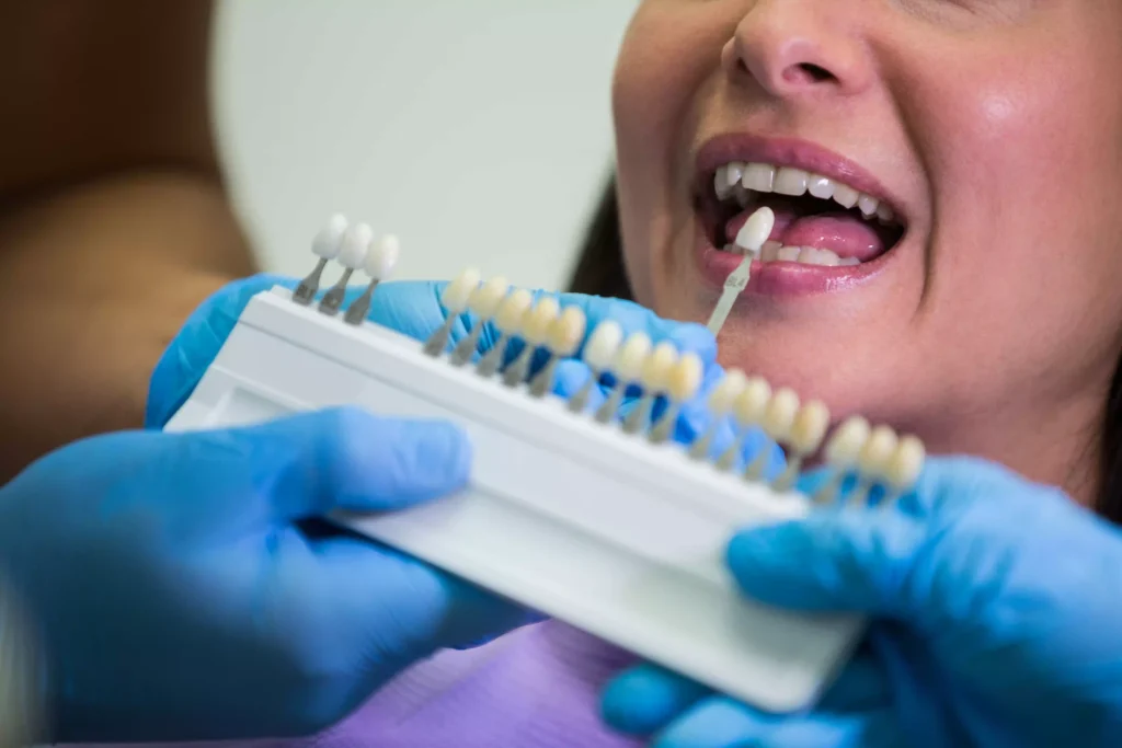 dental implant success rate