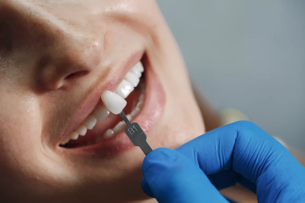 maintenance of dental implants